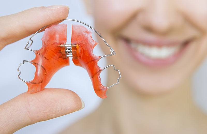 Ortodontik Aparey Nasıl Temizlenir